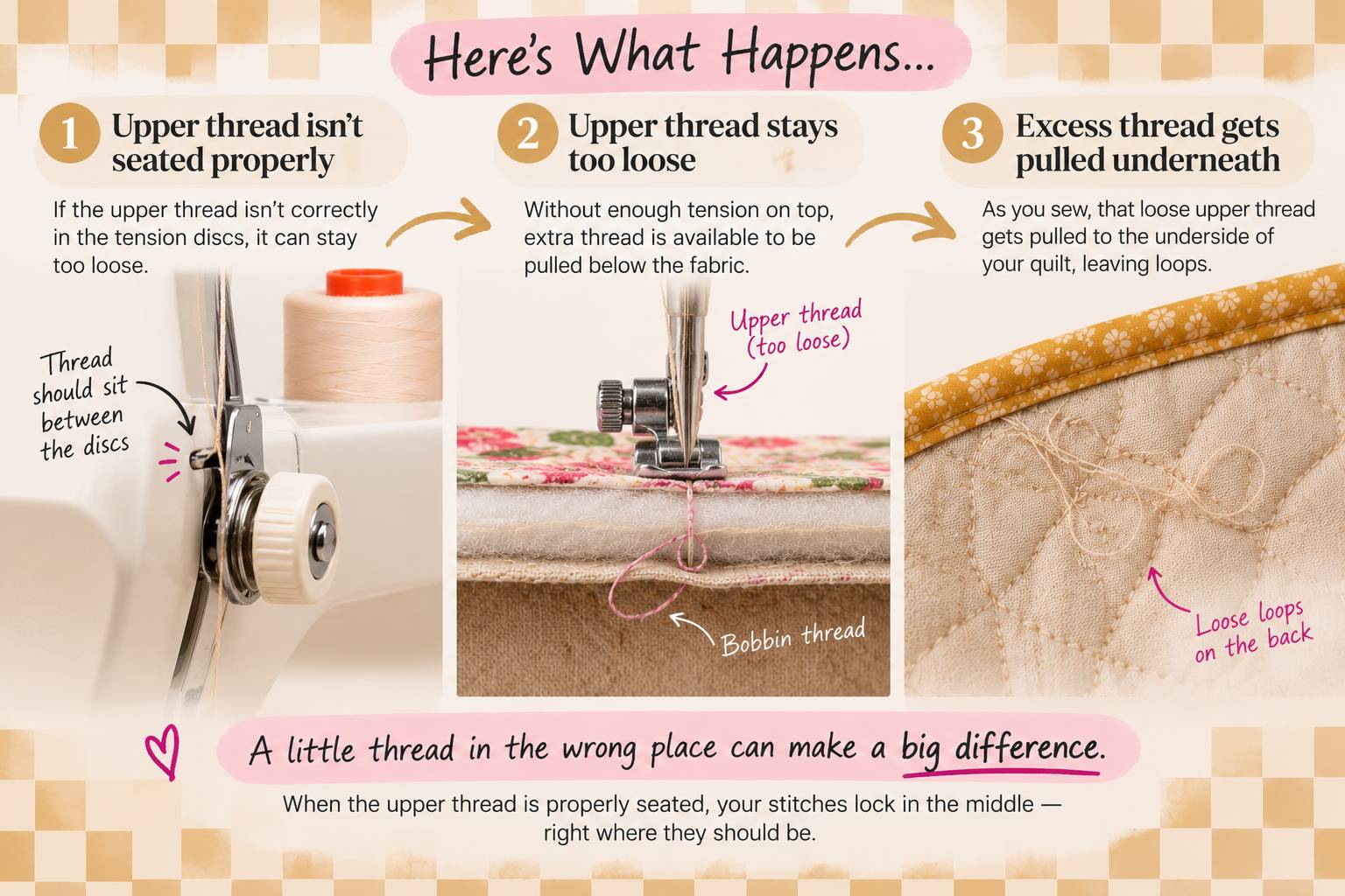 Infographic: why loops appear on the underside of a quilt — an upper thread not seated in the tension discs stays too loose and gets pulled to the bottom of the quilt